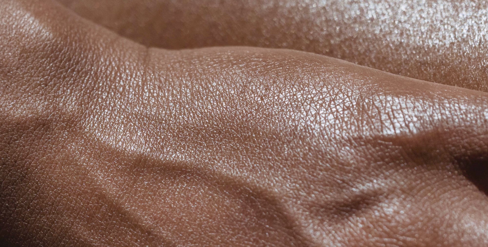 Close-up of brown skin